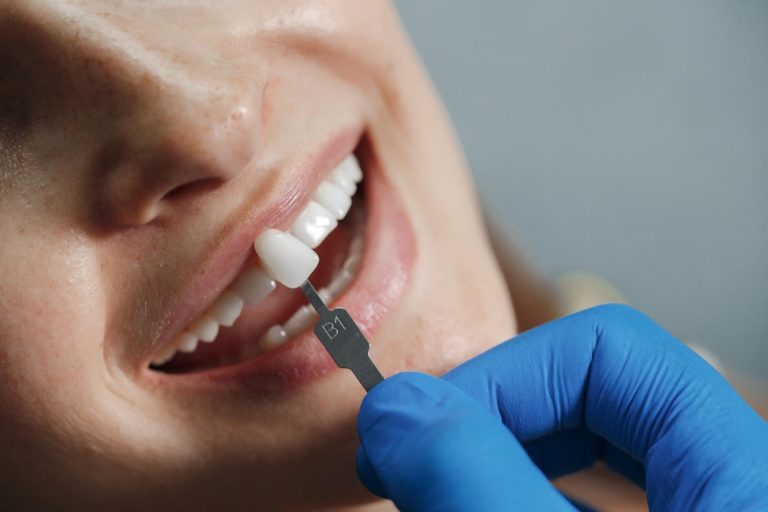¿Perdiste uno o varios dientes? En PerfectSmile Bogotá, realizamos implantes dentales con tecnología avanzada y expertos en cirugía oral. Devuelve la función y estética a tu sonrisa de forma natural y permanente. ¡Agenda tu diagnóstico!