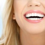 Aplaza los procedimientos dentales estéticos hasta después del parto